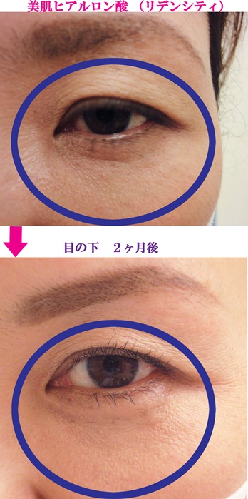 http://www.pure-clinic.com/m/eye-5s.jpg