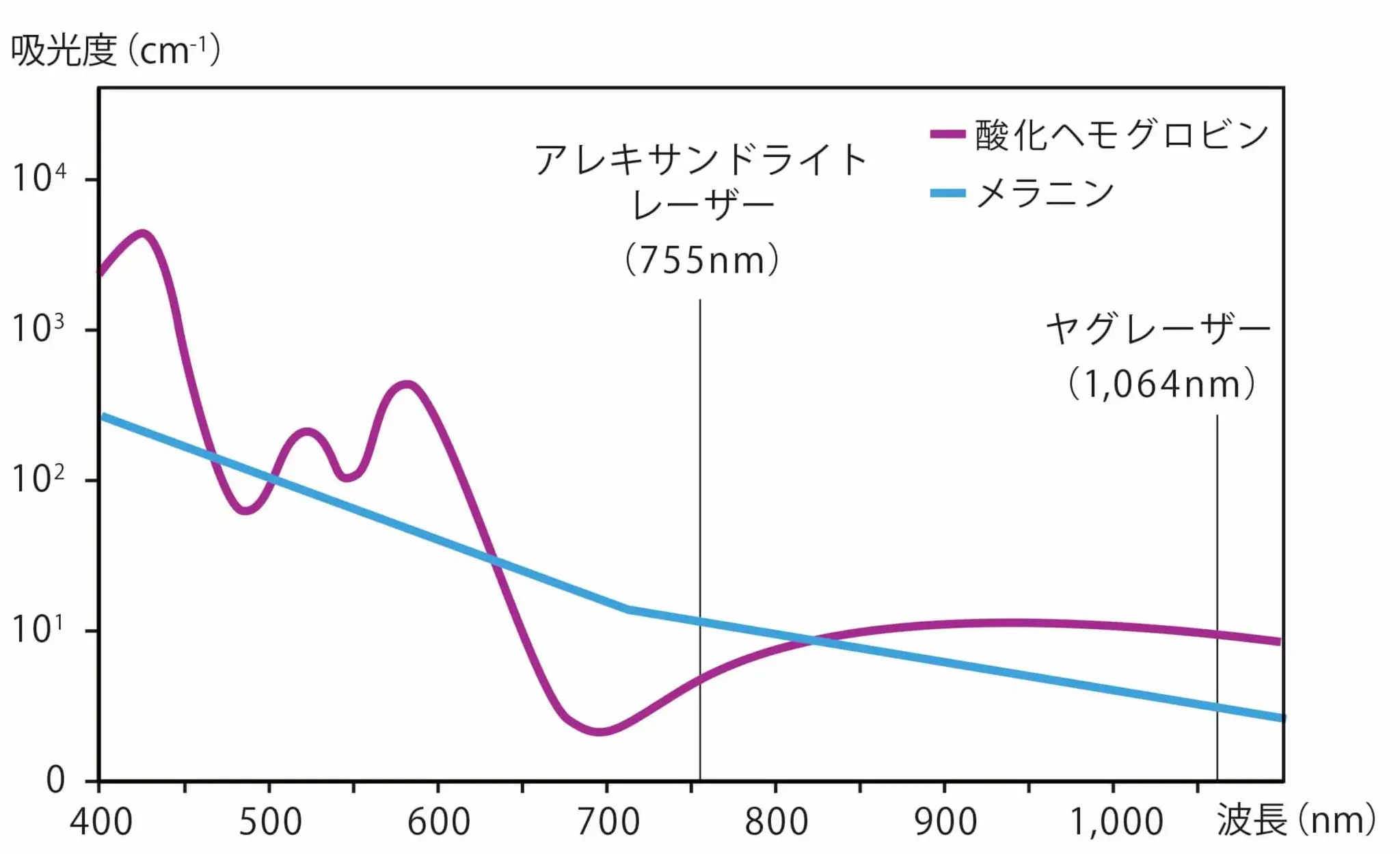 分光吸収曲線と各レーザー機器の波長